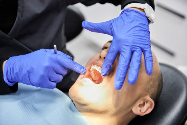 Best Knocked-Out Tooth Emergency  in Delisle, MS