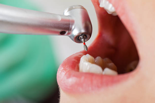 Best Emergency Gum Pain Relief  in Delisle, MS